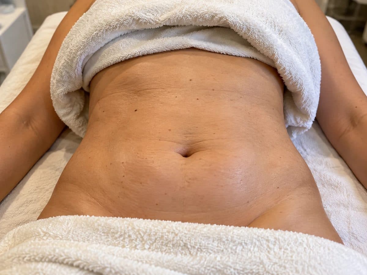 Before Lymphatic Massage treatment