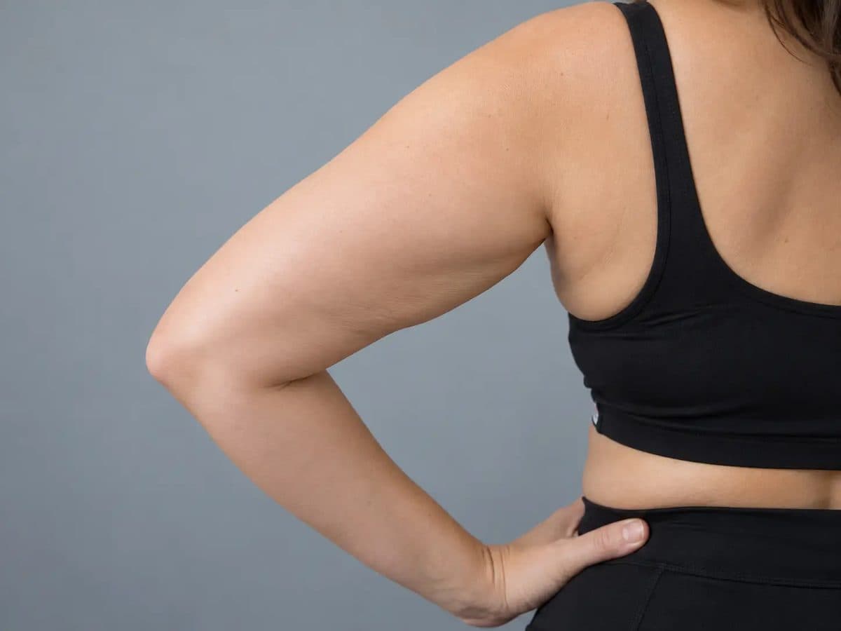 Before Have You Hit a Weight-Loss Plateau? treatment