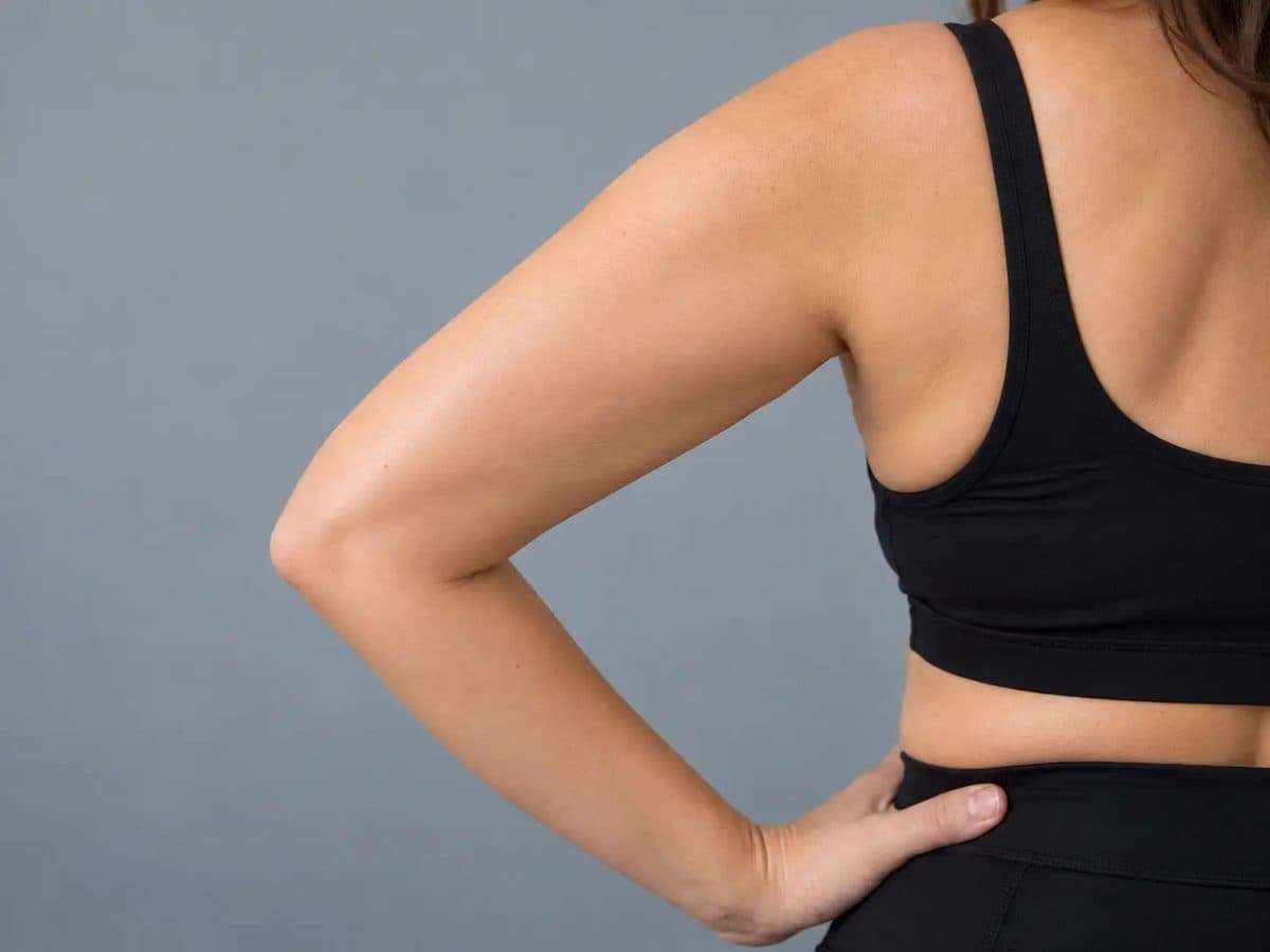 After Have You Hit a Weight-Loss Plateau? treatment at Allure Medical Aesthetics